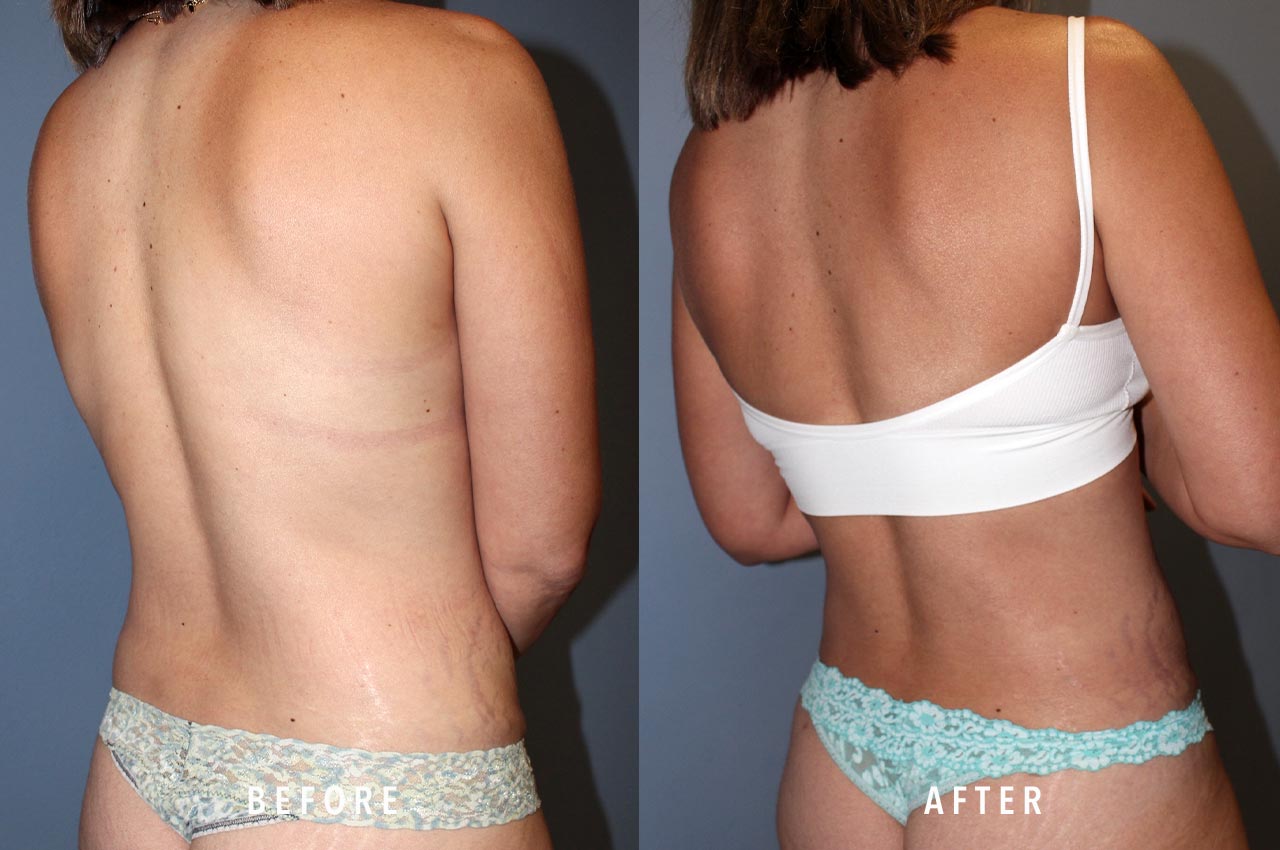 Body Plastic Surgery, The Woodlands